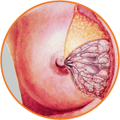 Breast Surgery